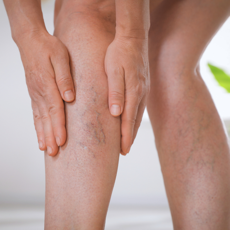 Angiologie Teaserbild